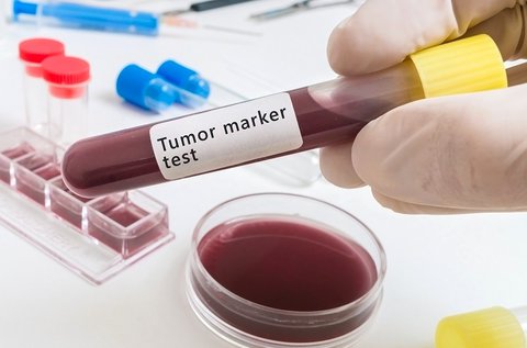Profi szűrőcsomag tumormarker szűréssel