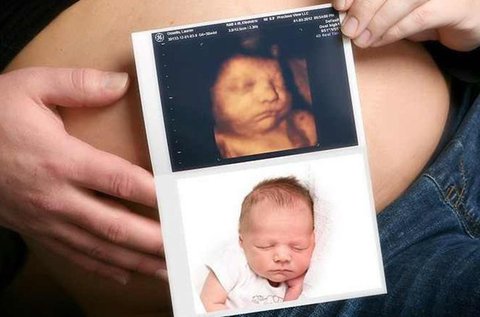 4D ultrahangos babamozi kisbabádról