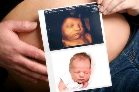 4D-s baba ultrahang videó- és képrögzítéssel