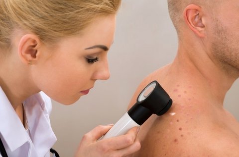 Melanoma vagy egyéb bőrbetegség szűrése