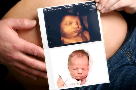 4D-s baba ultrahang videó- és képrögzítéssel