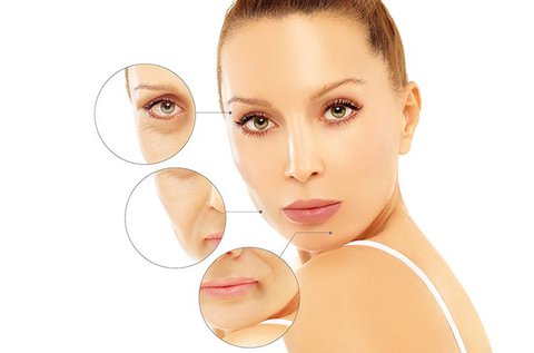 Látványos arcfiatalítás Soft Botox kezeléssel