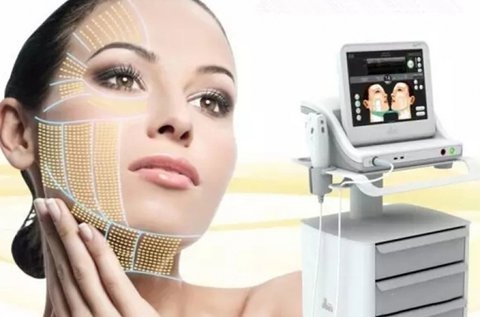 HIFU kezelés és fiatalítás arc területen