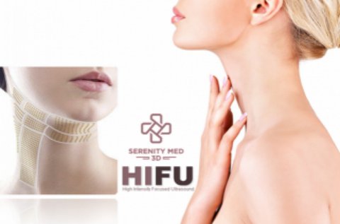 Feszes, ránctalan nyak 3D HIFU kezeléssel