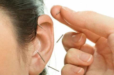 10 alkalmas fogyasztó akupunktúrás kezelés
