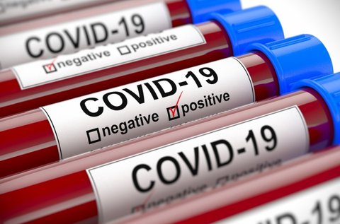 Koronavírus teszt antitest vizsgálattal