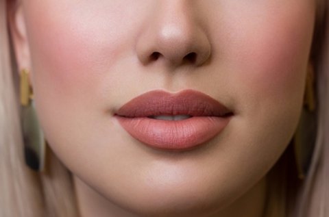 Telt ajkak hyaluronpen szájfeltöltéssel