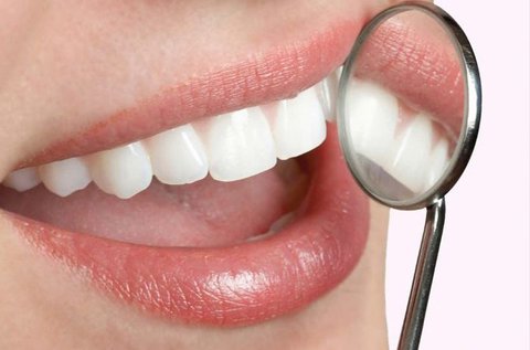 Ultrahangos fogkőleszedés alsó és felső fogíven