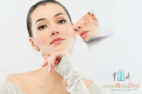 Bőrszépítő Carbon Peeling lézeres kezelés