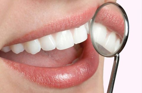 Egészséges fogsor fogkő-eltávolítással