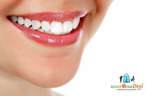 Tökéletes fogsor digitális mosolytervezéssel