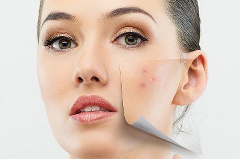 Kozmetikai nagykezelés hideglézerrel