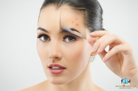 Skincare lézeres arckezelés és mikrodermabrázió