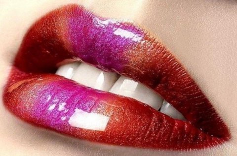 HyaluronPen szájfeltöltés