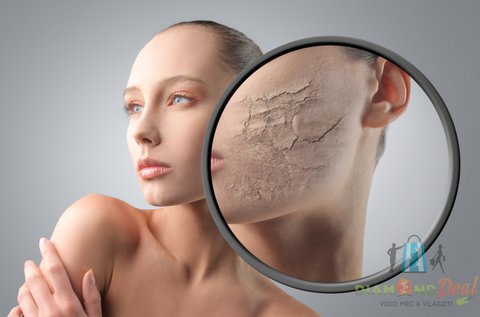 4 alkalmas Carbon Peeling lézeres kezelés