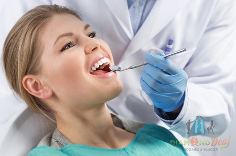 Fogkő leszedés fogfehérítő hatású polírozással