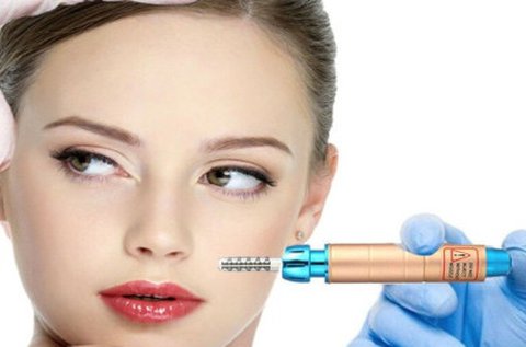 HyaluronPen ránc- vagy szájfeltöltés