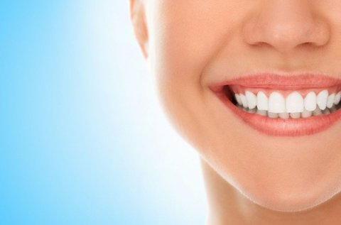 Fogkő-eltávolítás az ápolt fogakért
