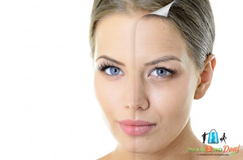 Oxy-kollagénes arckezelés a feszes és fiatalos bőrért