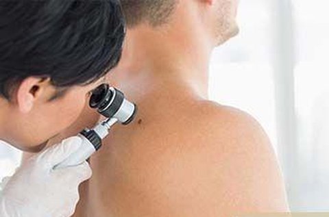 Dermatoszkópos anyajegy- és melanomaszűrés