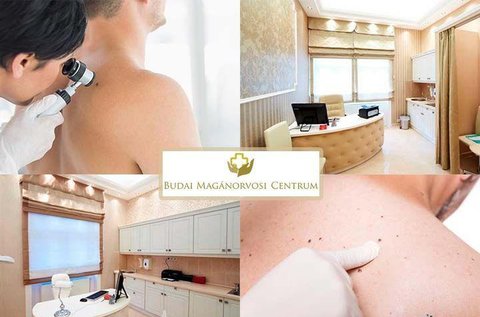 Dermatoszkópos anyajegy és melanoma szűrés