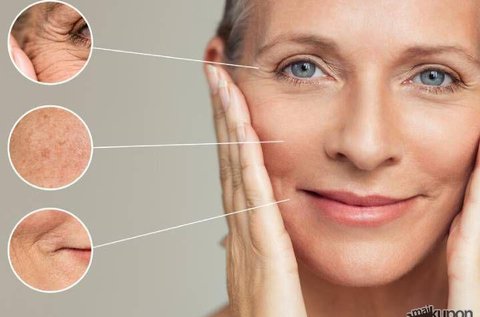 Rádiofrekvenciás nano mezoterápiás kezelés