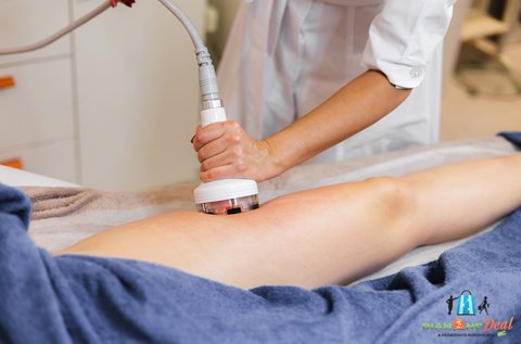 5 alkalmas kavitáció testtekercseléssel