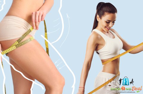 6 alkalmas lipo lézeres zsírbontás presszoterápiával
