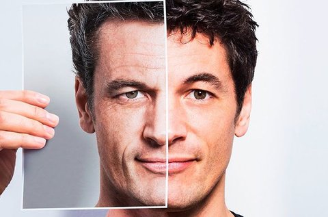 Ráncfeltöltő kezelés férfiaknak mezoterápiával