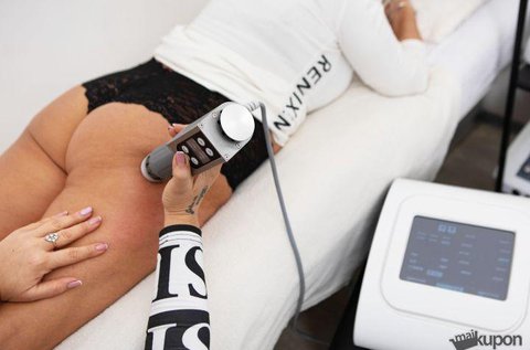 Shockwawe lökéshullám terápia alakformálásra