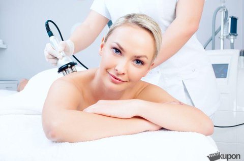 Rádiófrekvenciás és kavitációs  alakformálás