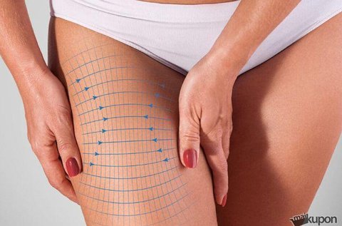 3 alkalmas zsírbontó és vízhajtó kezelés combról