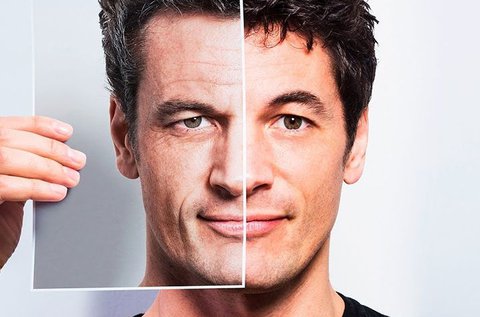 Ráncfeltöltő, extra feszesítő kezelés férfiaknak