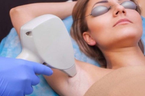 1 alkalmas valódi dióda lézeres szőrtelenítés