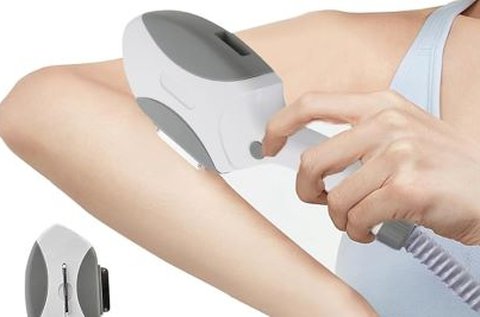 5 alkalom SHR OPT tartós szőrtelenítés
