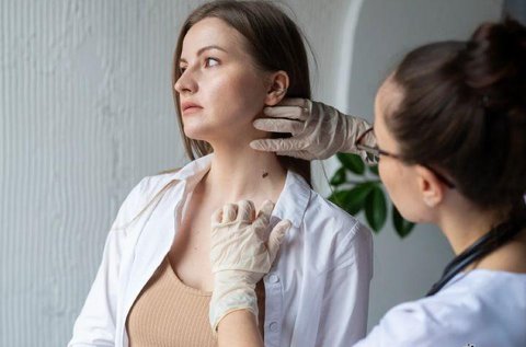 Vírusos szemölcs eltávolítása