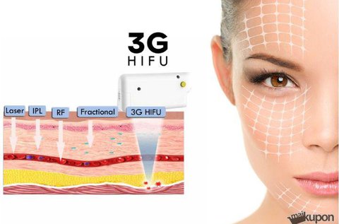 3G HIFU teljes arcfiatalítás