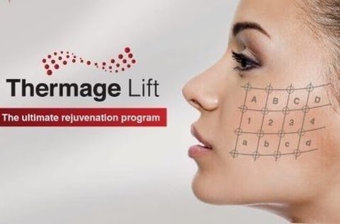 Thermage IV. mátrixpontos RF ránckezelés