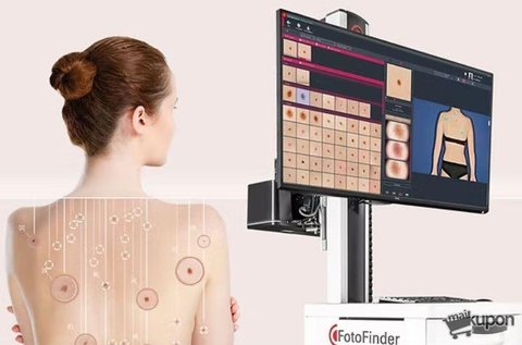 Fotofinder AI anyajegy szűrés