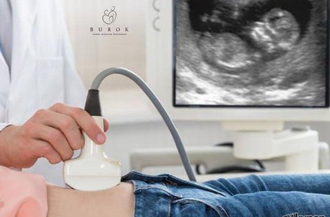 III. trimeszteri genetikai ultrahang szűrés