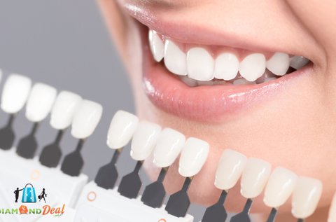 GC Tooth Mousse fogkezelés
