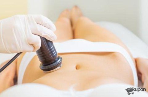 3 alkalmas kavitációs ultrahangos zsírbontás