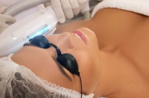 Bőrfiatalítás, rozácea és pigmentálódás kezelés