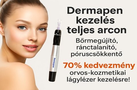 Dermapen kezelés 4D hyaluronsavakkal