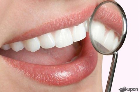 Ultrahangos fogkő-eltávolítás