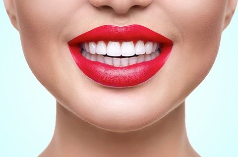 Peroxidmentes fogfehérítés fogkő-eltávolítással