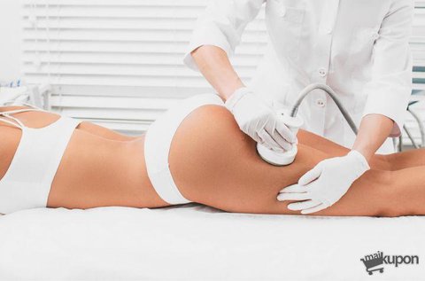 4 alkalmas kavitációs zsírbontó kezelés