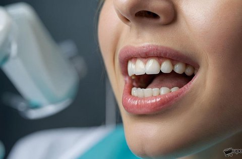 Safe Laser 500 Infra kezelés szájüregi gyulladásokra