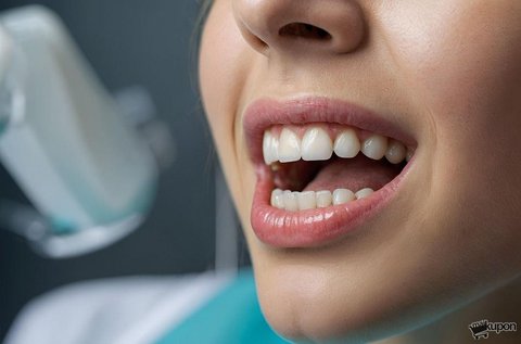 Kíméletes támogatás szájüregi gyulladásokra