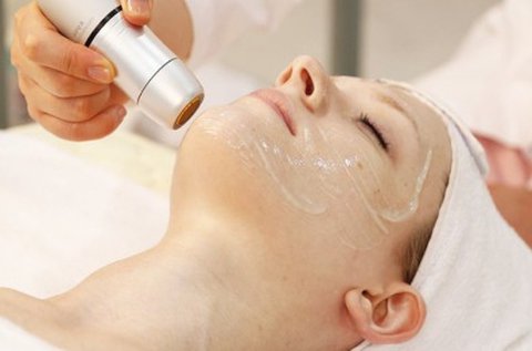 Beautamed HIFU PEN fiatalító kezelés teljes arcon